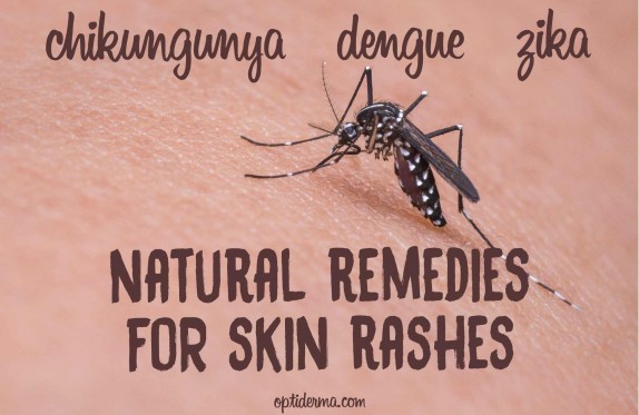 skin rashes caused by zika, chikungunya, dengue skin rashes caused by zika, chikungunya, dengue