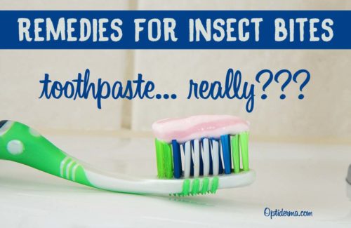 Toothpaste on Bug Bites - Mosquito Bites Toothpaste on Bug Bites - Mosquito Bites