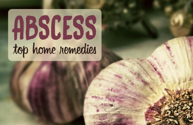 home remedies for abscess