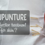 acupuncture for skin
