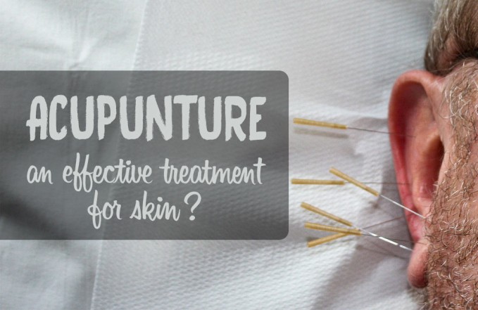 acupuncture for skin