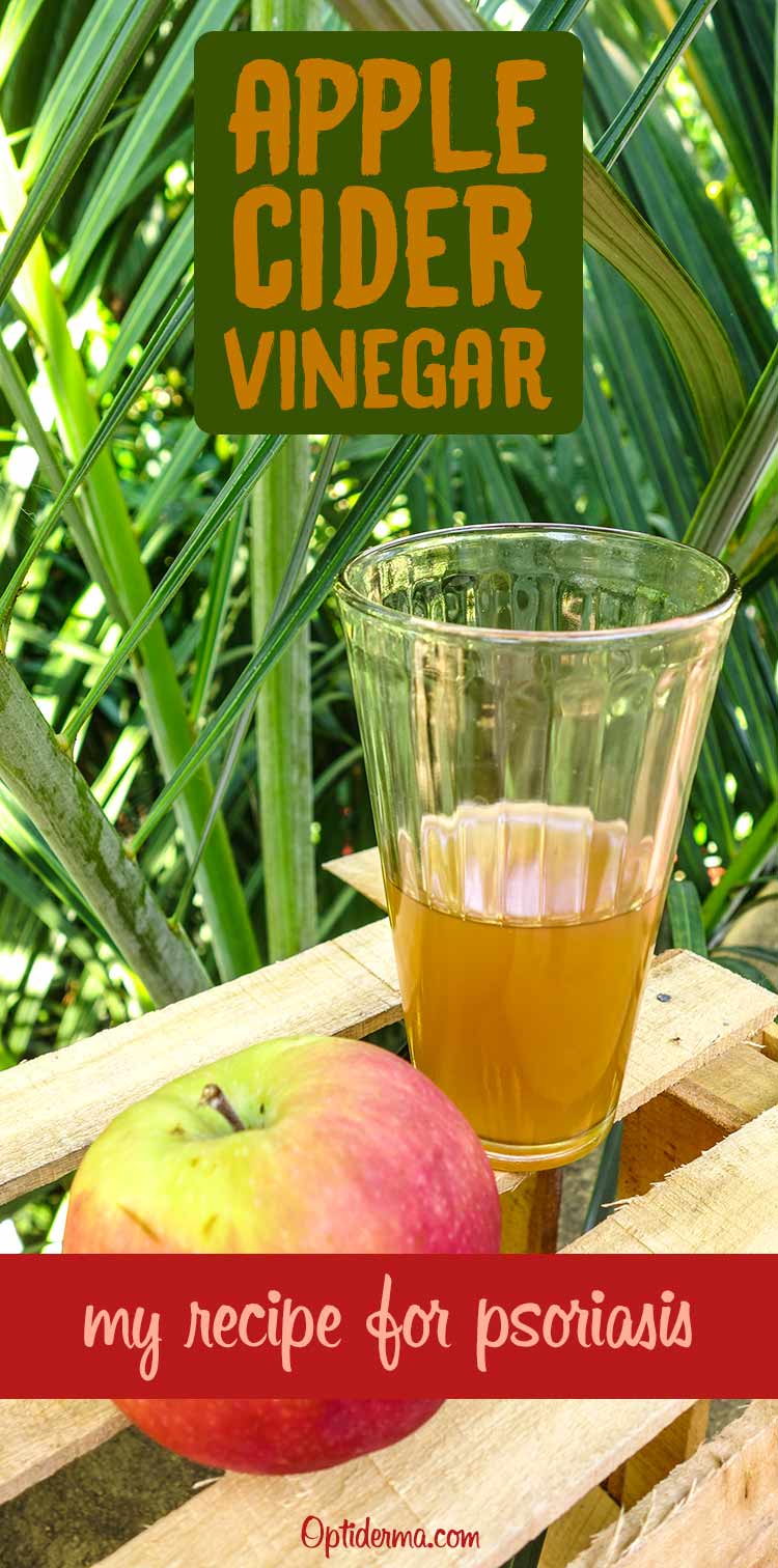 Apple Cider Vinegar for Psoriasis