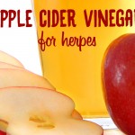 How to use apple cider vinegar for herpes