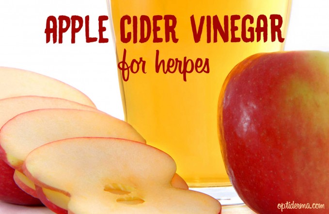 How to use apple cider vinegar for herpes