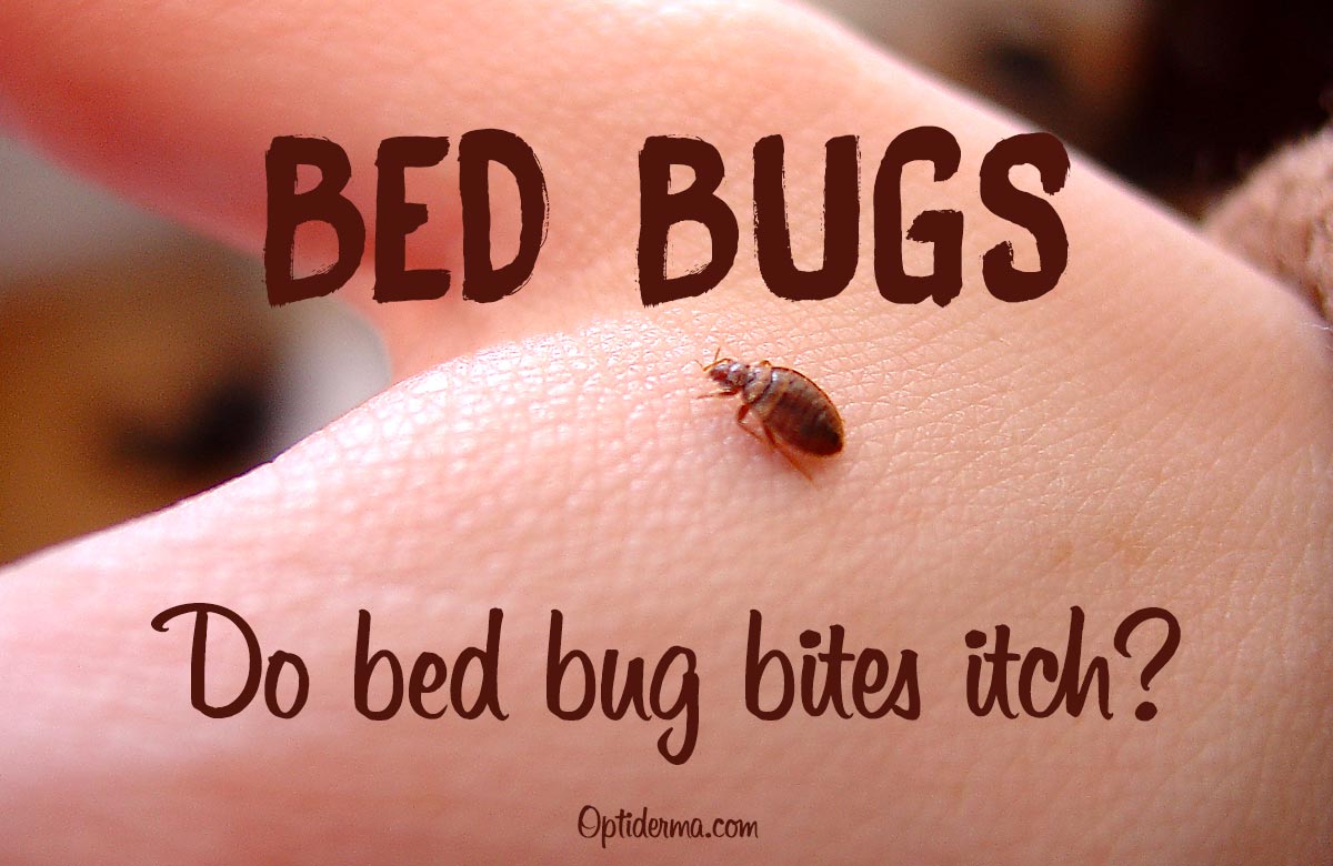 Do Bed Bug Bites Itch?