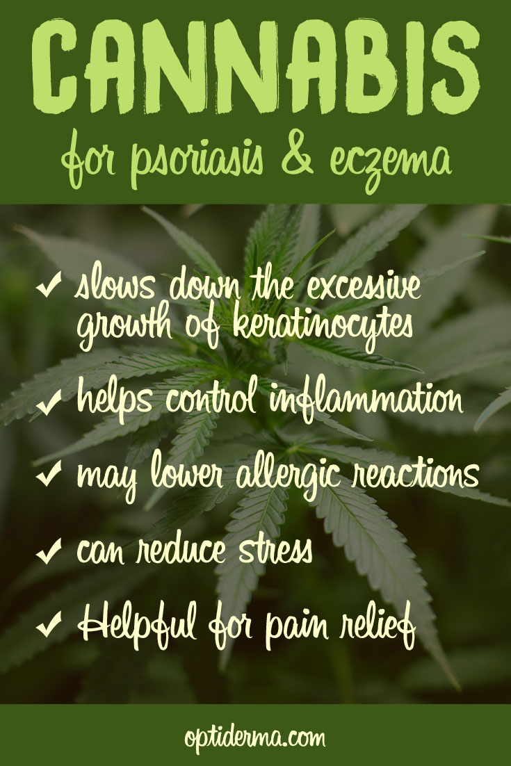 Benefits of Cannabis for Psoriasis & Eczema