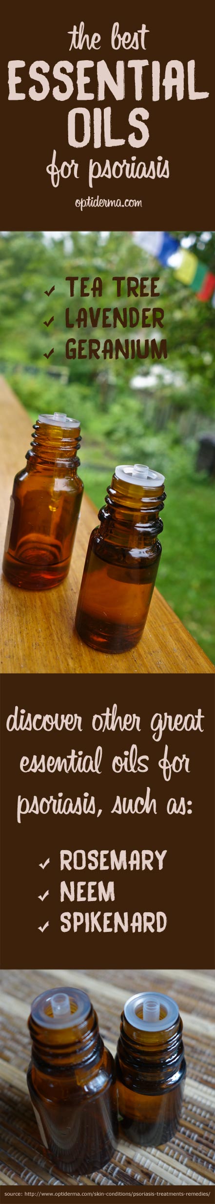 Essential oils for psoriasis & scalp psoriasis