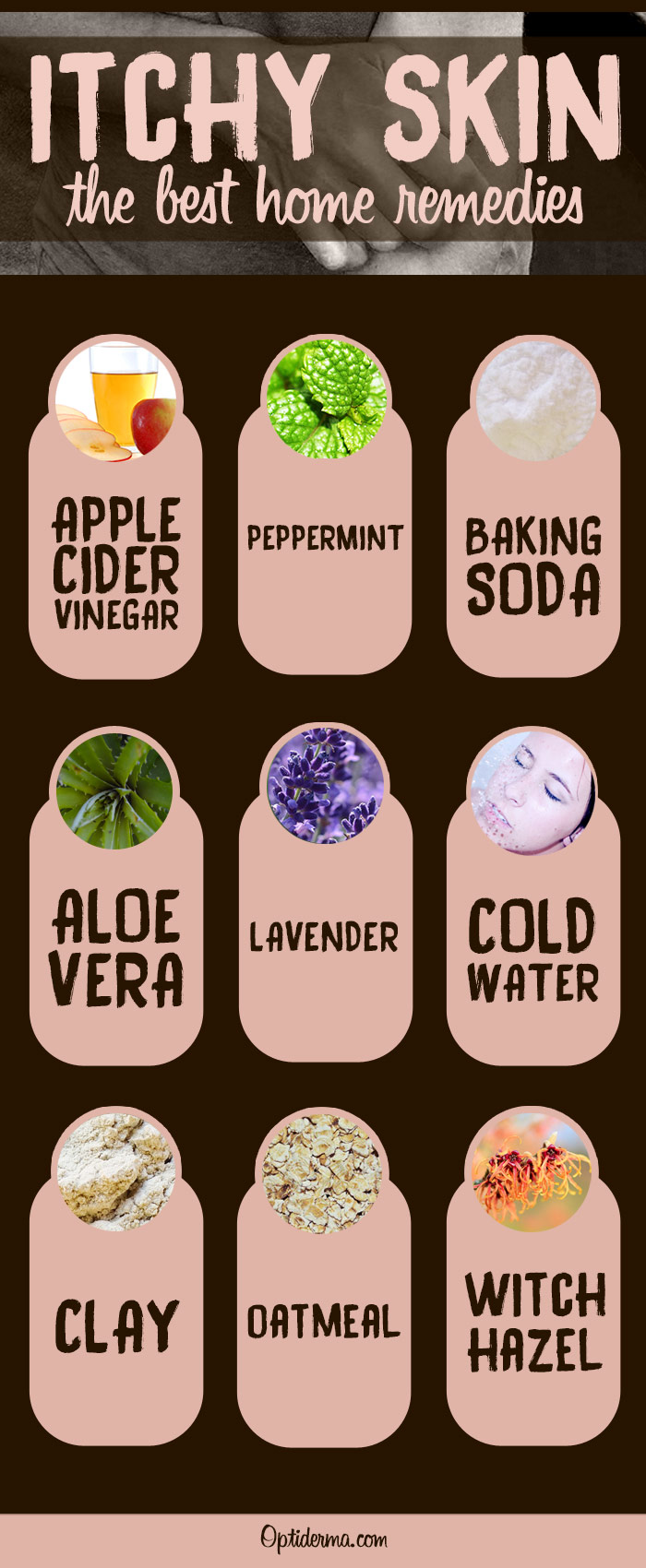 Home remedies deals for itchy skin