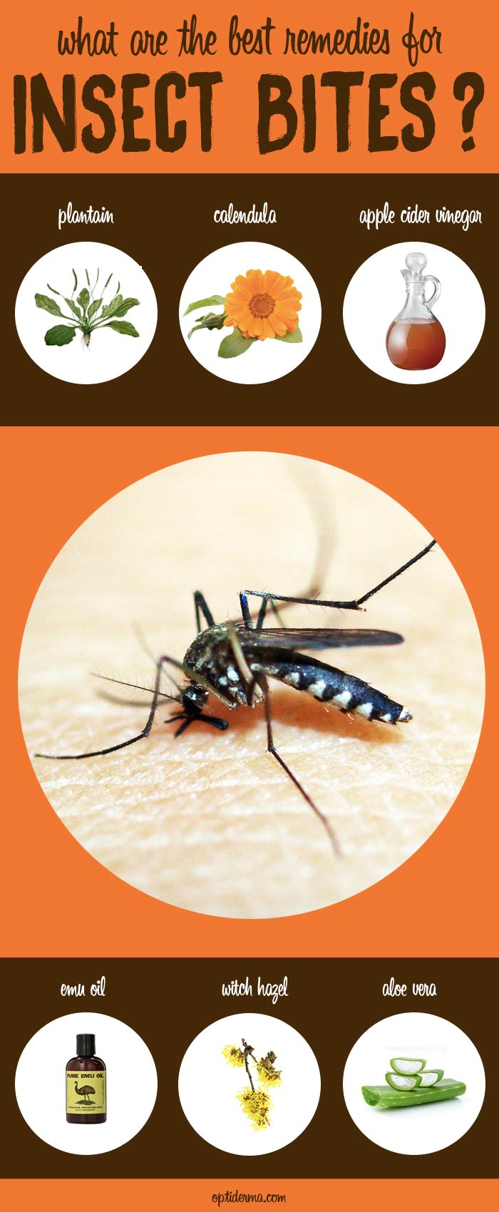 Best Remedies for Insect Bites