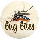 Remedies for Bug Bites Remedies for Bug Bites