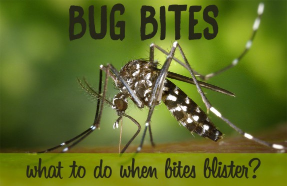 Bug bites that blister: Mosquito, Spider, Bed Bug Bites