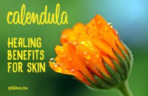 Calendula for Insect Bites, Cuts & Skin Rashes