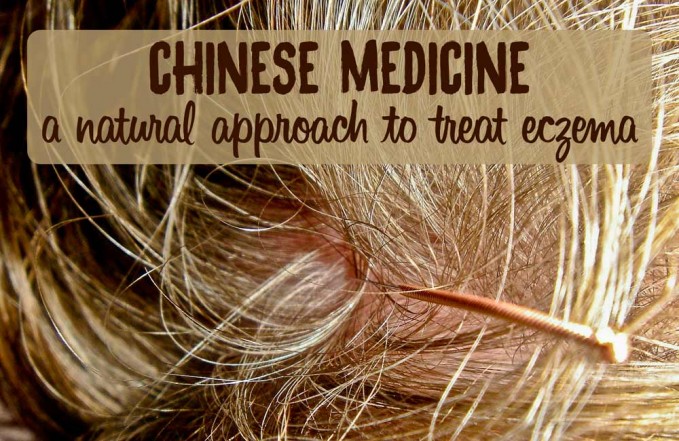 Chinese Medicine Eczema