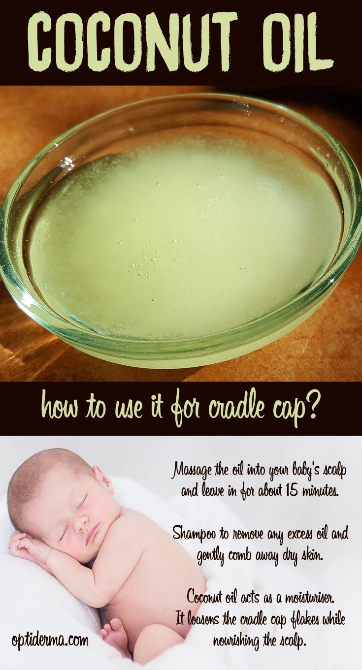 Coconut Oil for Cradle Cap