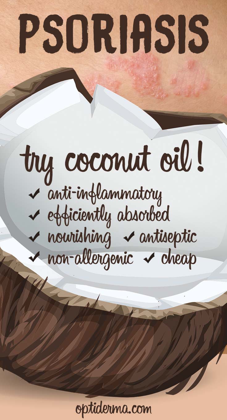 Why Use Coconut Oil for Psoriasis?