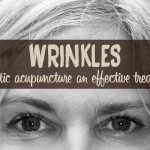 wrinkles cosmetic acupuncture treatment