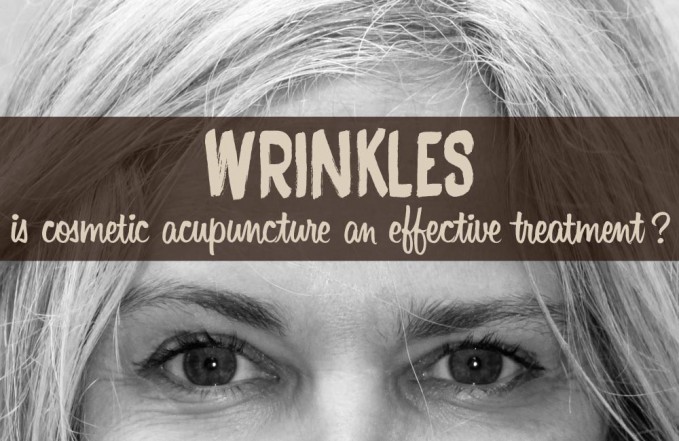 wrinkles cosmetic acupuncture treatment