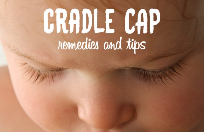 How to treat cradle cap