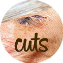 Remedies for Cuts & Wounds Remedies for Cuts & Wounds