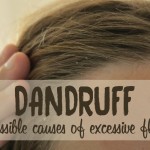 why do I have dandruff