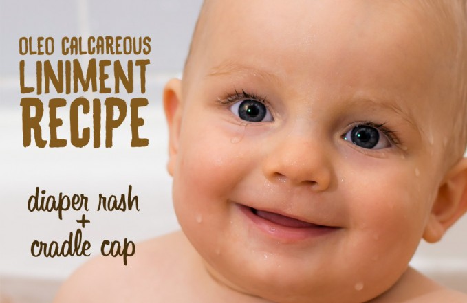 Oleo Calcareous Liniment for Baby Skin Rashes (cradle cap or diaper rash)