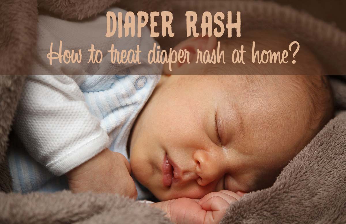 How Long Does it Take for a Diaper Rash to Go Away? Best Home Treatments