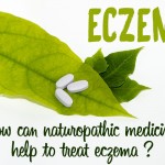 eczema naturopathic doctor