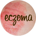 Eczema Eczema