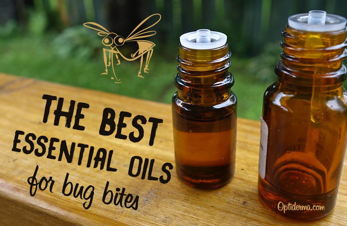 Best Essential Oils for Bug Bites