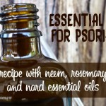 essential oils for psoriasis