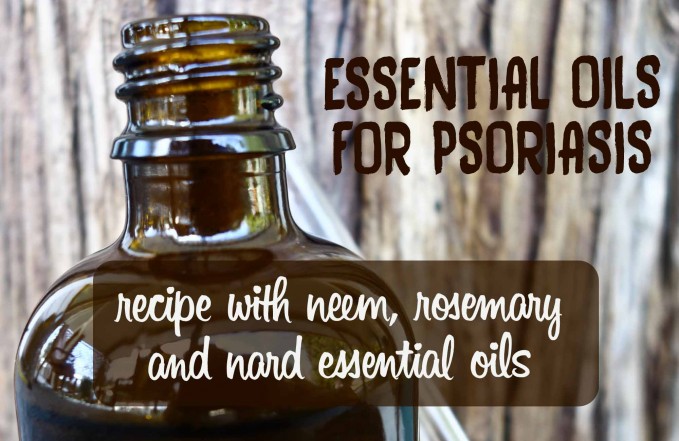 essential oils for psoriasis