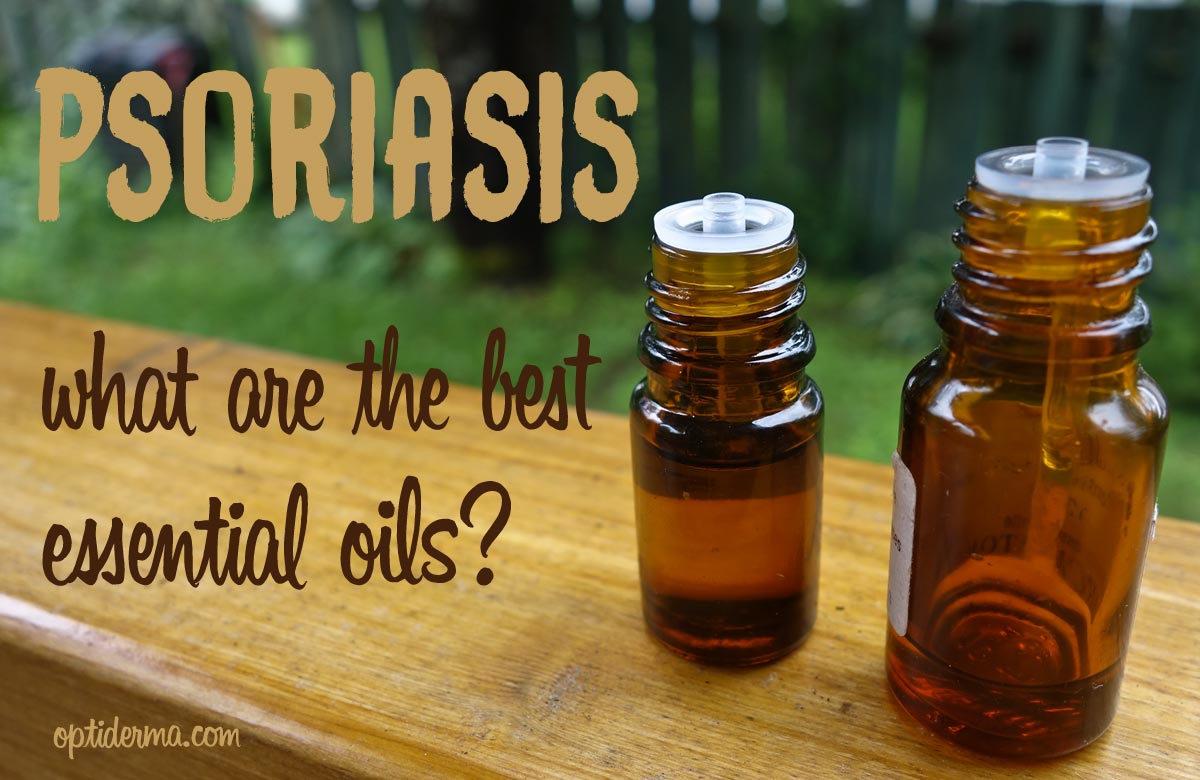 what are the best essential oils for psoriasis & scalp psoriasis
