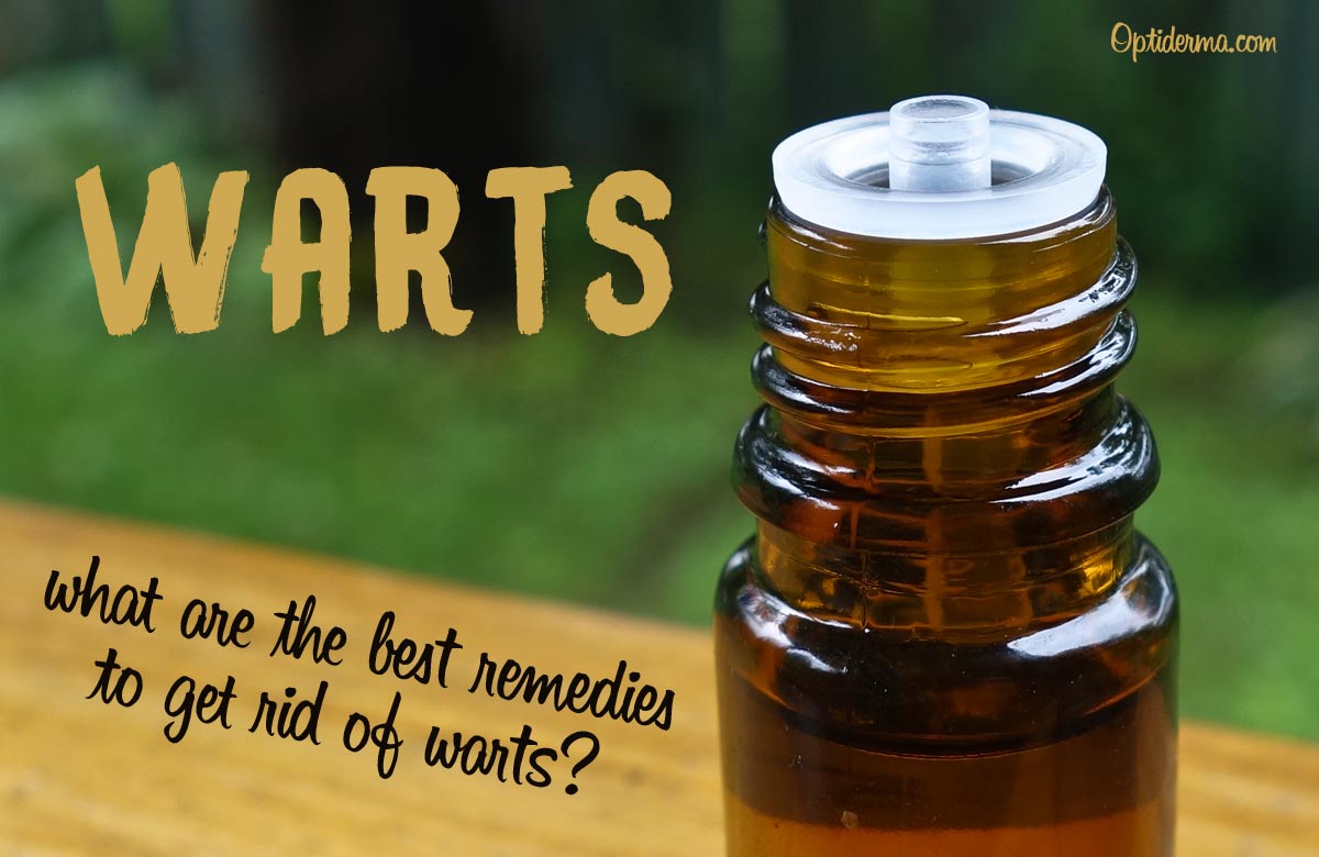 What Are the Best Essential Oils for Warts Removal?