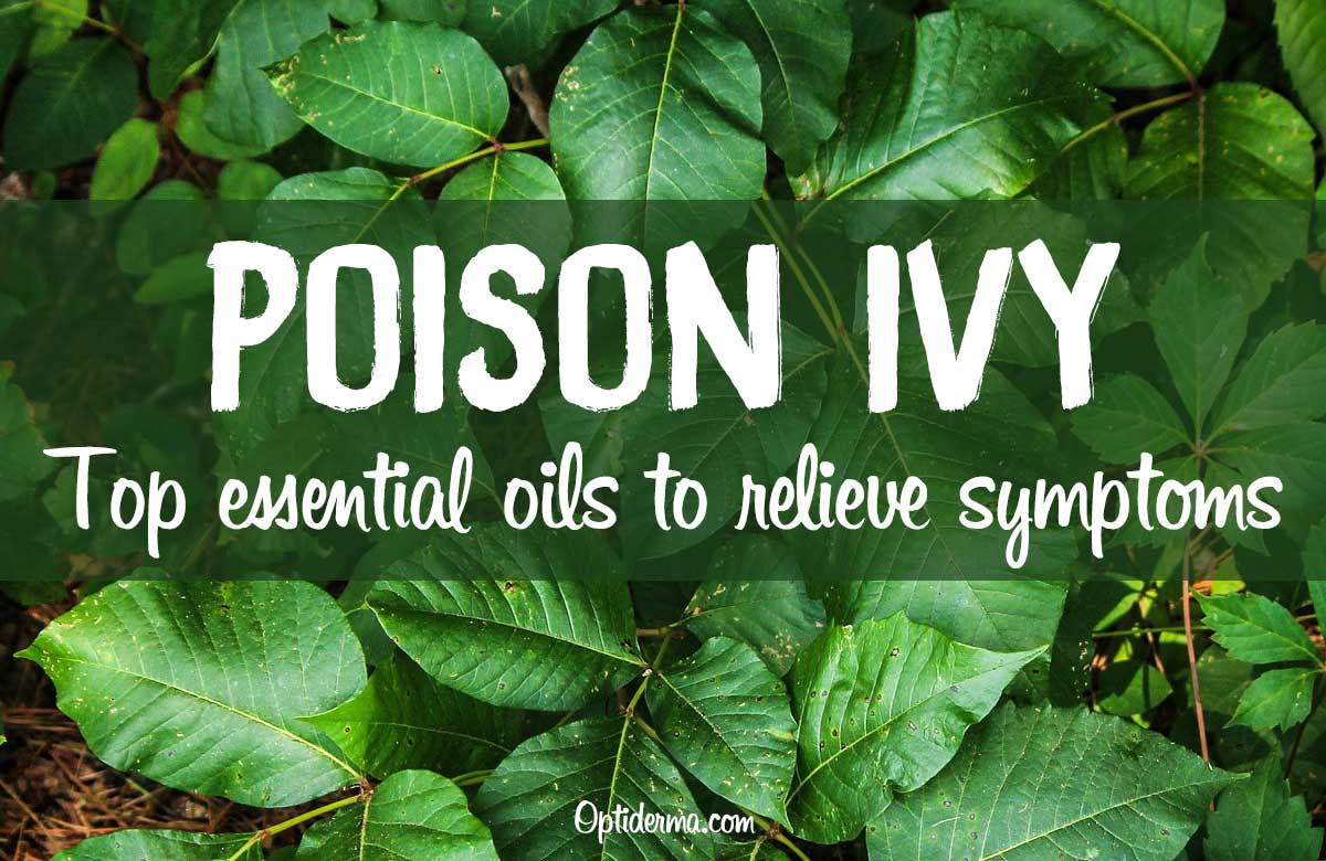 Essential Oils for Poison Ivy