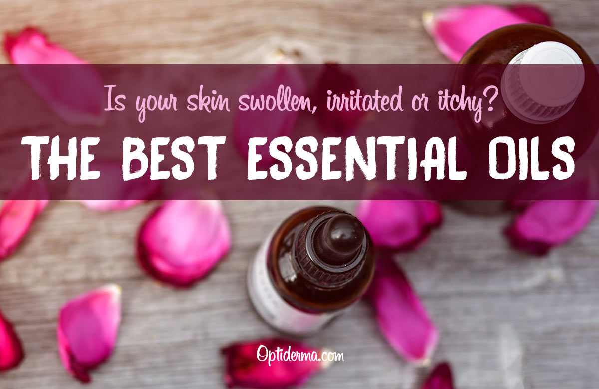 Best Essential Oils for Skin Rashes