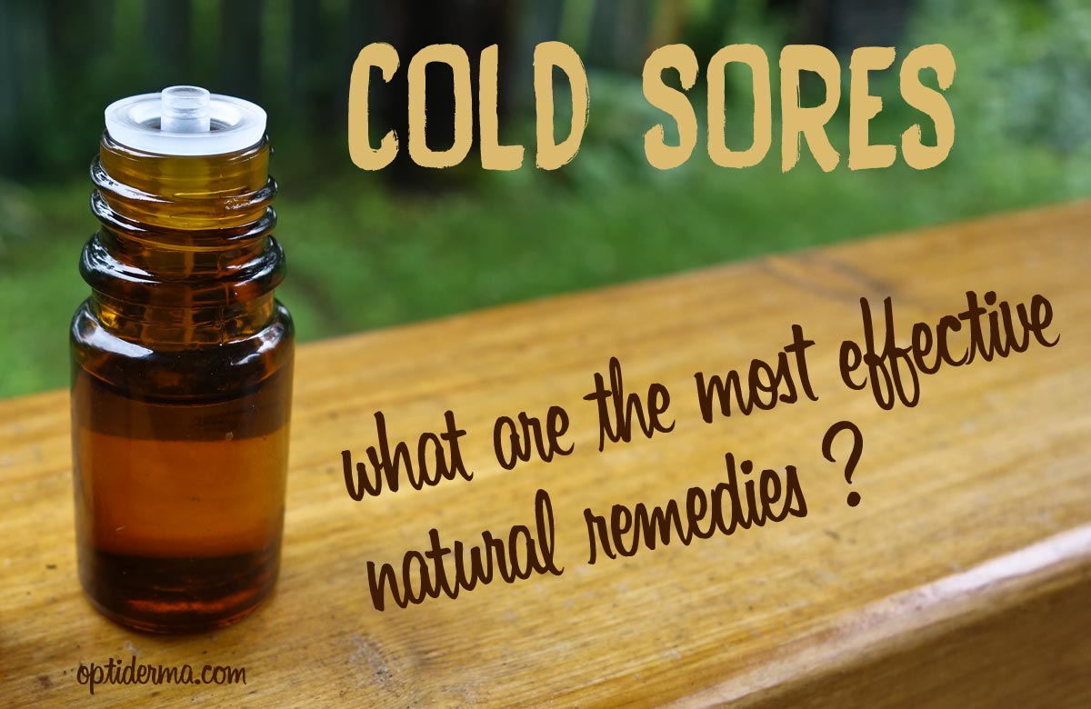 Essential Oils for Fever Blisters Other Powerful Remedies