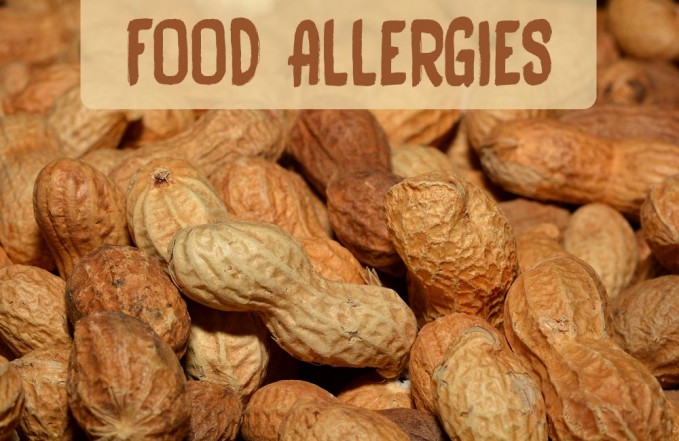 food allergies