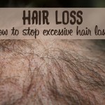 Saw Palmetto for Hair Loss