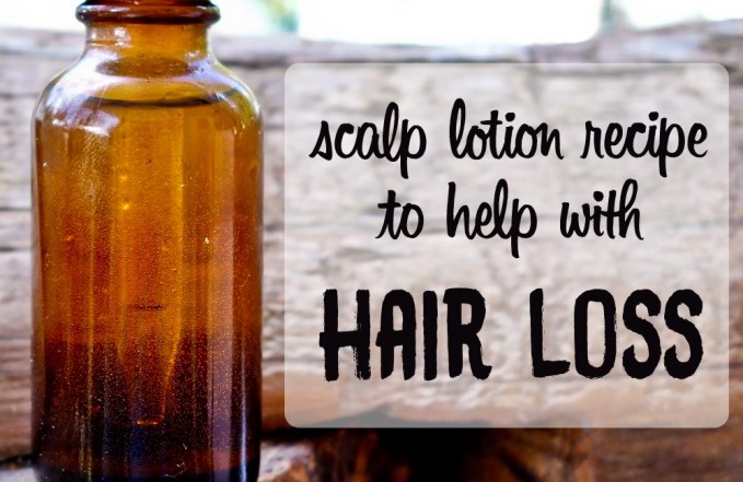 Hair loss lotion