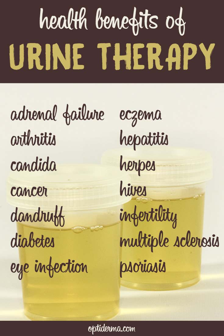 Health Benefits of Urine Therapy