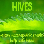 hives urticaria naturopathy