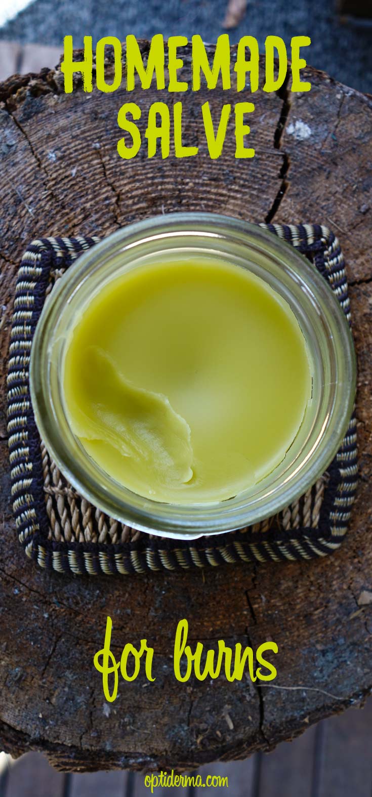 Homemade Salve for Burns