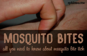 How Long Do Mosquito Bites Itch For?