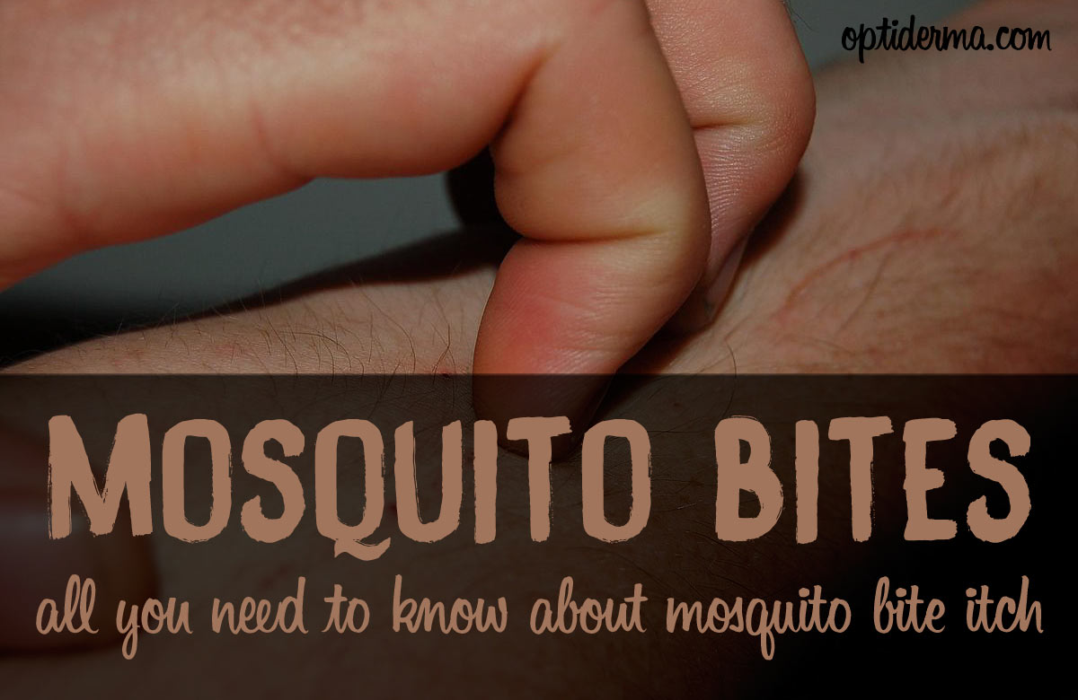 How Long Do Mosquito Bites Itch For?