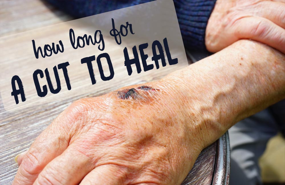 Best Foods For Open Wound Healing Best Foods For Open Wound Healing