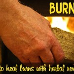 Herbs for Burns