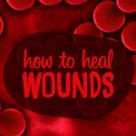 How to heal wounds faster