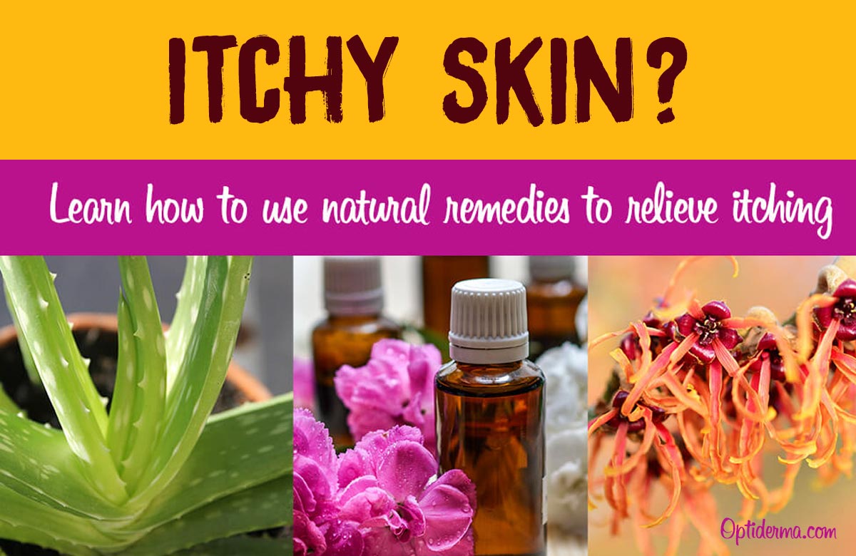 Remedies for Itchy Skin