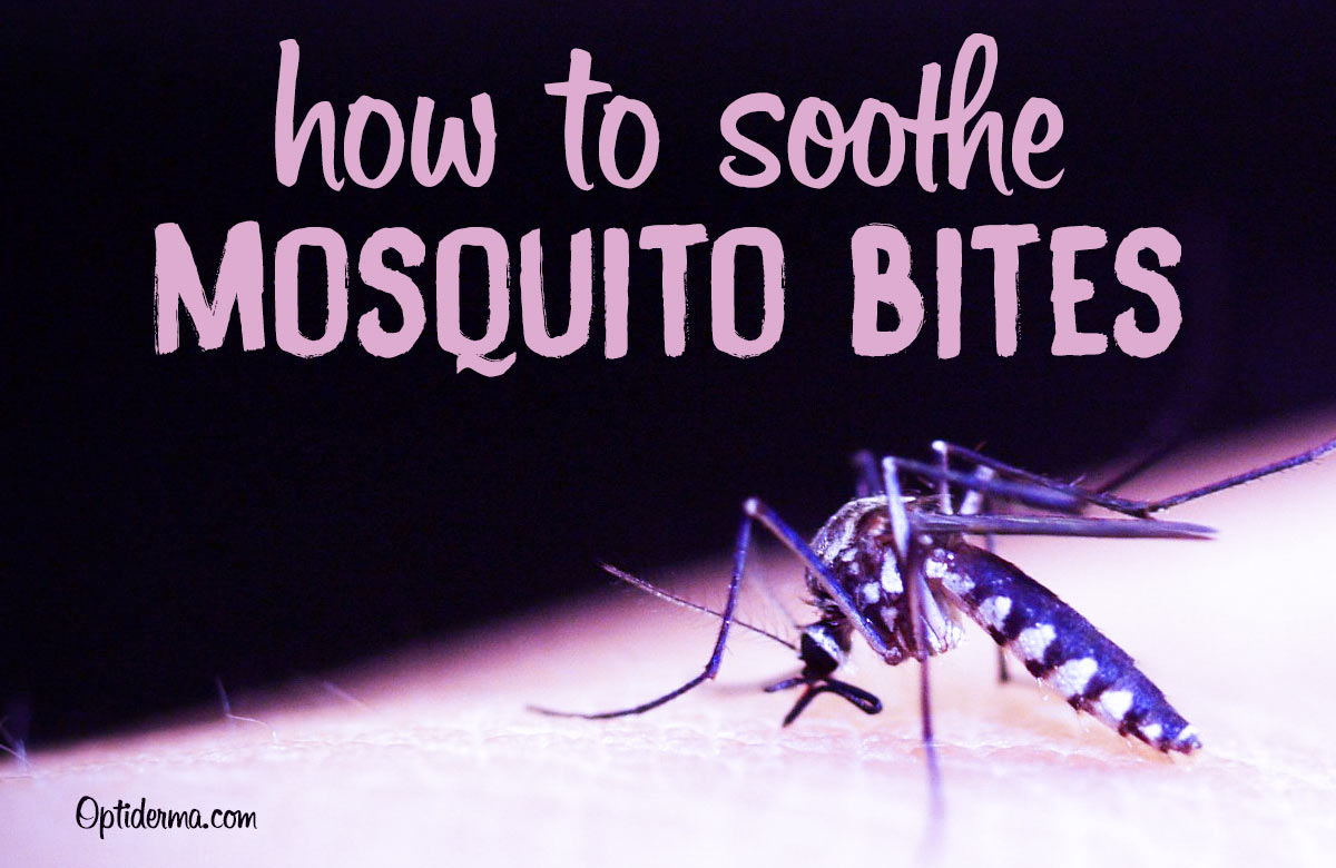 Lavender Essential Oil for Mosquito Bites - How to Soothe Bug Bites