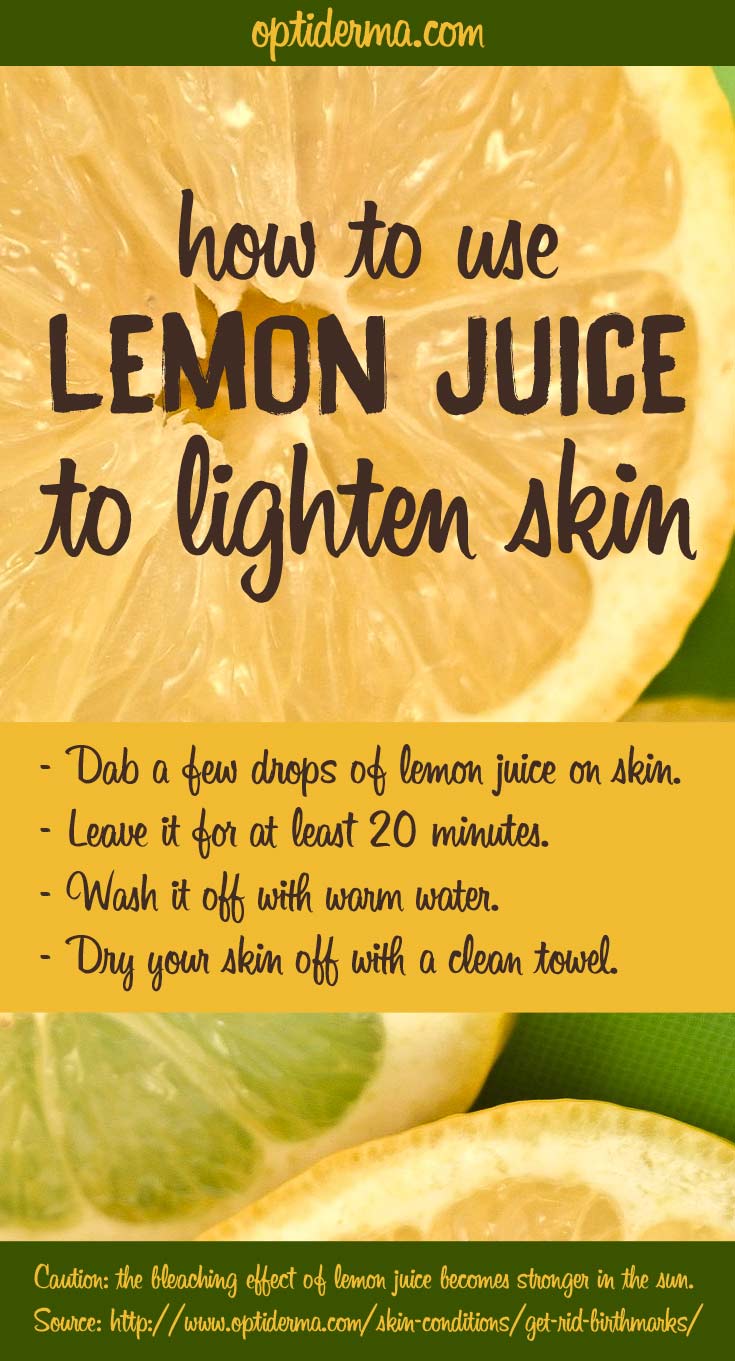 How to Use Lemon Juice to Lighten Skin and Get Rid of Birthmarks